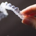 The Benefits of Invisalign Cleaning Glasses