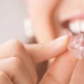 SmileDirectClub vs Invisalign: Which is the Best Option for Teeth Alignment?