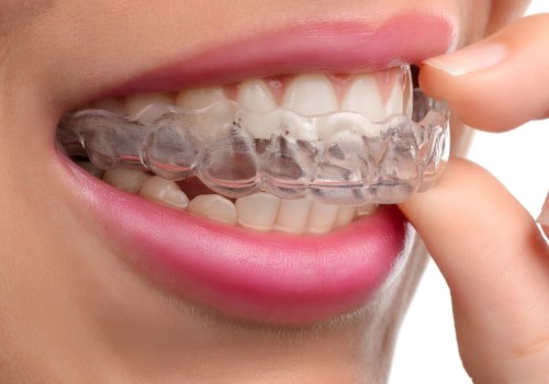 What Hurts More: Invisalign or Braces?